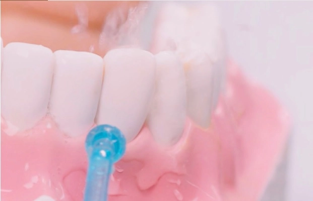 Máy tăm nước cầm tay Xiaomi Soocas W3, vệ sinh răng miệng (01 đầu phun đi kèm)